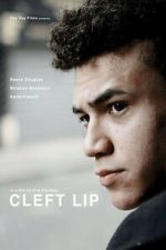 Watch Cleft Lip M4uhd