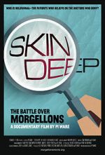 Watch Skin Deep: The Battle Over Morgellons M4uhd