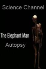 Watch Science Channel Elephant Man Autopsy M4uhd