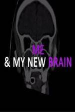 Watch Me & My New Brain M4uhd