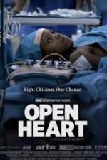 Watch Open Heart M4uhd