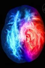 Watch Brain on Fire M4uhd