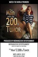 Watch The Man With The 200lb Tumor M4uhd