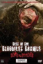 Watch TNA Wrestling: Best of the Bloodiest Brawls - Scars and Stitches M4uhd