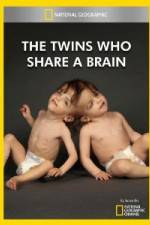 Watch National Geographic The Twins Who Share A Brain M4uhd