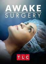 Watch Awake Surgery M4uhd