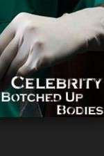 Watch Celebrity Botched Up Bodies M4uhd